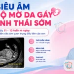 banner siêu âm đo độ mờ da gáy _ BS Thanh Quốc - Sản phụ khoa